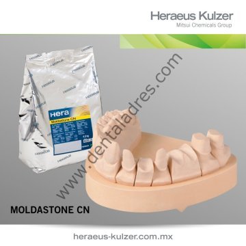 Moldastone (4,5 KG)